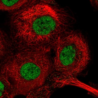 Immunocytochemistry/Immunofluorescence: GTF2H1 Antibody [NBP2-38556] - Immunofluorescent staining of human cell line A-431 shows localization to nucleoplasm.