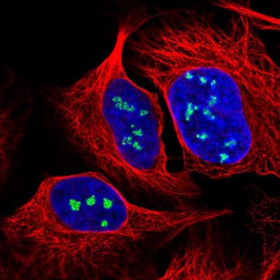 Immunocytochemistry/Immunofluorescence: NOP56 Antibody [NBP2-13666] - Immunofluorescent staining of human cell line U-2 OS shows localization to nucleoli fibrillar center.