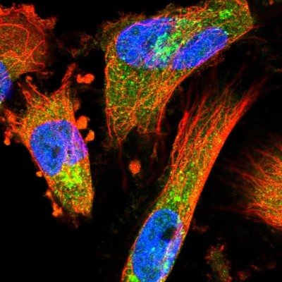 Immunocytochemistry/Immunofluorescence: COPE Antibody [NBP2-38512] - Immunofluorescent staining of human cell line U-251 MG shows localization to the Golgi apparatus.