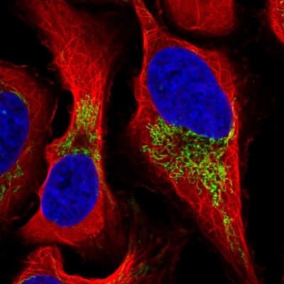 Immunocytochemistry/Immunofluorescence: Ferredoxin Reductase Antibody [NBP2-38530] - Staining  of human cell line U-2 OS shows positivity in mitochondria.