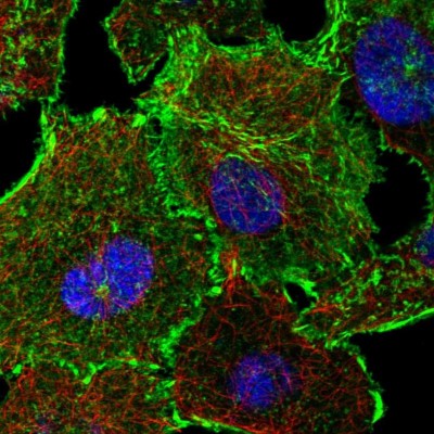 Immunocytochemistry/Immunofluorescence: C19orf21 Antibody [NBP2-38955] - Immunofluorescent staining of human cell line A549 shows localization to plasma membrane & focal adhesion sites.