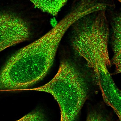 Immunocytochemistry/Immunofluorescence: LGTN Antibody [NBP1-81308] - Immunofluorescent staining of human cell line U-2 OS shows localization to nuclear bodies & cytosol.