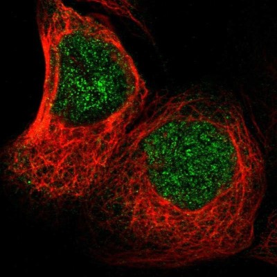 Immunocytochemistry/Immunofluorescence: TMEM132D Antibody [NBP1-93563] - Staining of human cell line A-431 shows positivity in nucleus.