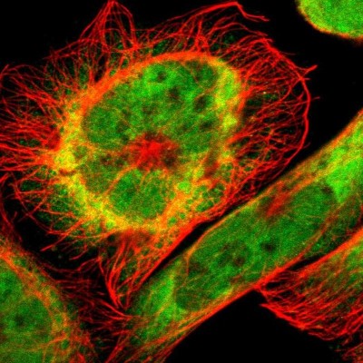 Immunocytochemistry/Immunofluorescence: RING1 Antibody [NBP1-80830] - Immunofluorescent staining of human cell line A-431 shows localization to nucleoplasm & cytosol.