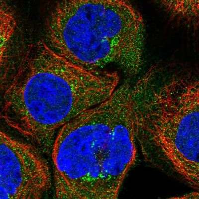 Immunocytochemistry/Immunofluorescence: CHST12 Antibody [NBP1-91784] - Staining of human cell line A-431 shows positivity in golgi apparatus.