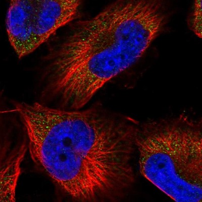 Immunocytochemistry/Immunofluorescence: Aminopeptidase P1/XPNPEP1 Antibody [NBP1-80614] - Immunofluorescent staining of human cell line U-251 MG shows localization to cytosol.