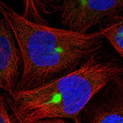 Immunocytochemistry/Immunofluorescence: ZNF189 Antibody [NBP1-85915] - Staining  of human cell line U-2 OS shows positivity in cytoskeleton (intermediate filaments) and aggresome.