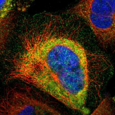 Immunocytochemistry/Immunofluorescence: Centaurin alpha 1 Antibody [NBP1-88097] - Immunofluorescent staining of human cell line A-431 shows localization to plasma membrane & cytosol.