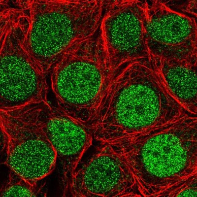 Immunocytochemistry/Immunofluorescence: SLMO2 Antibody [NBP2-33497] - Immunofluorescent staining of human cell line MCF7 shows localization to nucleoplasm.