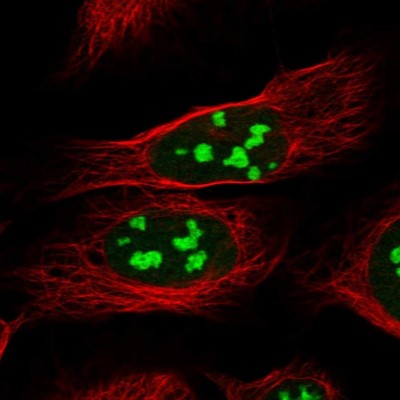 Immunocytochemistry/Immunofluorescence: CCDC137 Antibody [NBP2-31033] - Immunofluorescent staining of human cell line U-2 OS shows localization to nucleoli.