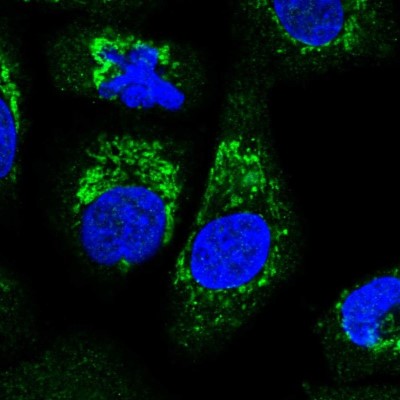 Immunocytochemistry/Immunofluorescence: ALDH16A1 Antibody [NBP2-31774] - Immunofluorescent staining of human cell line A549 shows localization to mitochondria.