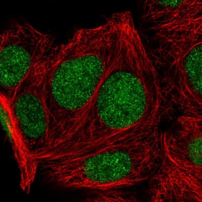 Immunocytochemistry/Immunofluorescence: KLF16 Antibody [NBP2-30580] - Immunofluorescent staining of human cell line MCF7 shows localization to nucleus.