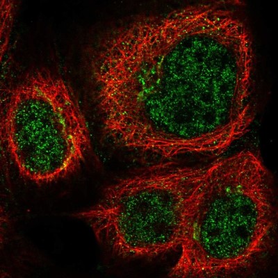 Immunocytochemistry/Immunofluorescence: TTDN1 Antibody [NBP2-31718] - Immunofluorescent staining of human cell line A-431 shows localization to nucleoplasm & the Golgi apparatus.