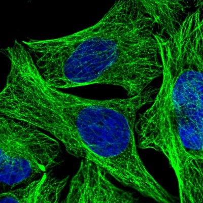 Immunocytochemistry/Immunofluorescence: DEPDC4 Antibody [NBP1-90592] - Immunofluorescent staining of human cell line U-2 OS shows localization to microtubules.