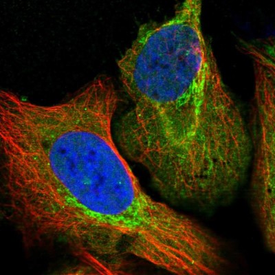 Immunocytochemistry/Immunofluorescence: Aldehyde dehydrogenase 5 Antibody [NBP1-90192] - Immunofluorescent staining of human cell line U-2 OS shows localization to nucleoplasm & mitochondria.