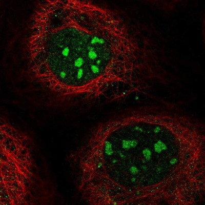 Immunocytochemistry/Immunofluorescence: KIF25 Antibody [NBP1-92055] - Staining of human cell line A-431 shows positivity in nucleus and nucleoli.