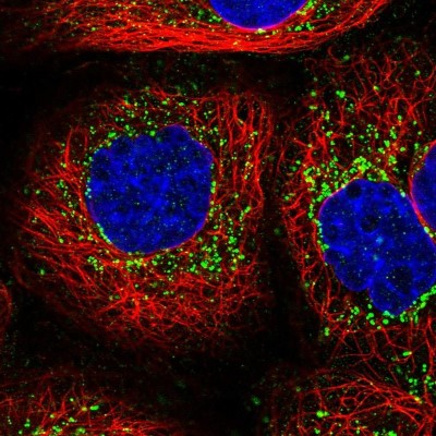 Immunocytochemistry/Immunofluorescence: MLC1SA Antibody [NBP1-92124] - Immunofluorescent staining of human cell line A-431 shows localization to vesicles.