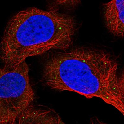 Immunocytochemistry/Immunofluorescence: ANKRD2 Antibody [NBP1-91670] - Immunofluorescent staining of human cell line U-2 OS shows localization to vesicles.