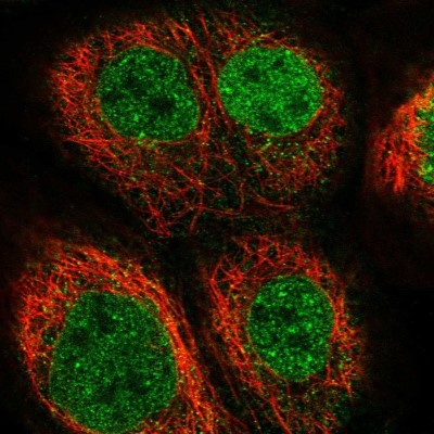 Immunocytochemistry/Immunofluorescence: EOGT/AER61 Antibody [NBP1-90224] - Staining of human cell line A-431 shows localization to nucleoplasm & nuclear membrane.