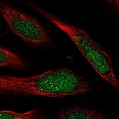 Immunocytochemistry/Immunofluorescence: CCDC127 Antibody [NBP1-91756] - Staining of human cell line U-2 OS shows localization to nucleus & nucleoli fibrillar center.