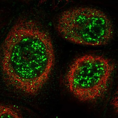 Immunocytochemistry/Immunofluorescence: KIAA1328 Antibody [NBP1-90892] - Staining of human cell line A-431 shows positivity in nucleus but not nucleoli and vesicles.
