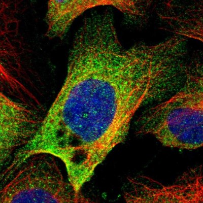 Immunocytochemistry/Immunofluorescence: KIAA0494 Antibody [NBP1-86098] - Immunofluorescent staining of human cell line U-2 OS shows localization to cytosol.