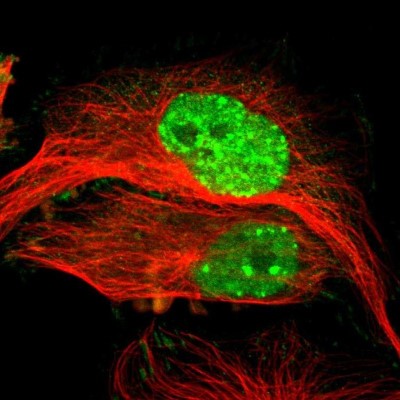 Immunocytochemistry/Immunofluorescence: MDC1 Antibody [NBP1-84860] - Staining of human cell line U-251 MG shows localization to nucleoplasm, nuclear bodies & focal adhesion sites.