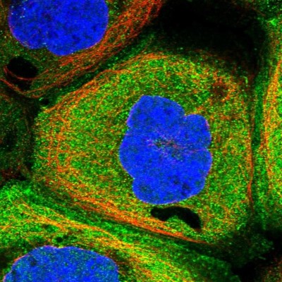 Immunocytochemistry/Immunofluorescence: C4orf22 Antibody [NBP1-86203] - Staining  of human cell line A-431 shows positivity in plasma membrane and cytoplasm.
