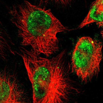 Immunocytochemistry/Immunofluorescence: ZNF222 Antibody [NBP1-86148] - Immunofluorescent staining of human cell line U-251 MG shows localization to nucleoplasm.