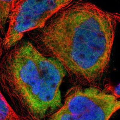Immunocytochemistry/Immunofluorescence: GPSM2 Antibody [NBP1-85231] - Staining of human cell line A-431 shows positivity in nucleus but not nucleoli and cytoplasm.