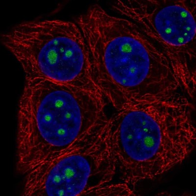 Immunocytochemistry/Immunofluorescence: HDHD3 Antibody [NBP1-86706] - Immunofluorescent staining of human cell line MCF7 shows localization to nucleoli.