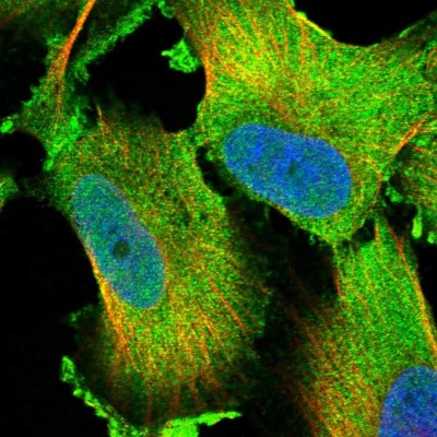Immunocytochemistry/Immunofluorescence: LTV1 Antibody [NBP1-86735] - Immunofluorescent staining of human cell line U-251 MG shows localization to nucleoplasm & cytosol.