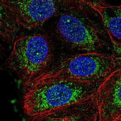 Immunocytochemistry/Immunofluorescence: NDUFS3 Antibody [NBP1-85619] - Immunofluorescent staining of human cell line MCF7 shows localization to nuclear bodies & mitochondria.