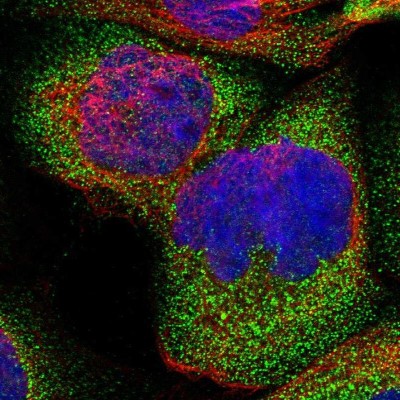 Immunocytochemistry/Immunofluorescence: CROT Antibody [NBP1-85501] - Immunofluorescent staining of human cell line A-431 shows localization to vesicles.
