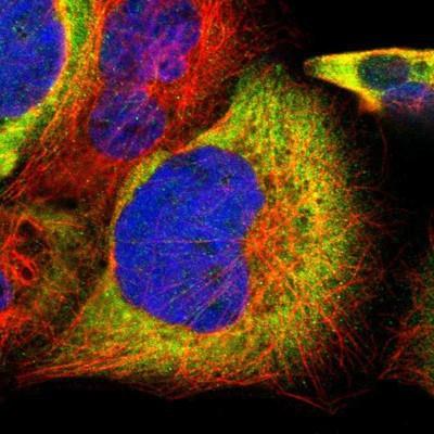 Immunocytochemistry/Immunofluorescence: EVI2B Antibody [NBP1-85342] - Staining of human cell line A-431 shows positivity in cytoplasm.