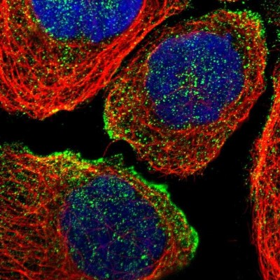 Immunocytochemistry/Immunofluorescence: SLC45A3/Prostein Antibody [NBP1-89630] - Immunofluorescent staining of human cell line A-431 shows localization to vesicles.