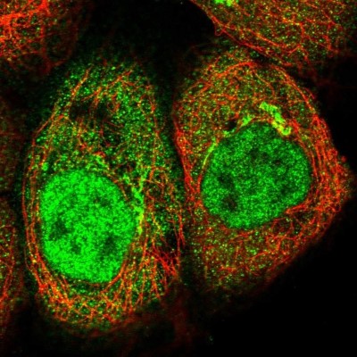 Immunocytochemistry/Immunofluorescence: AKR1CL2 Antibody [NBP1-90195] - Staining of human cell line A-431 shows positivity in nucleus but not nucleoli, cytoplasm and golgi apparatus.