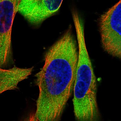 Immunocytochemistry/Immunofluorescence: CRYZ Antibody [NBP1-89536] - Immunofluorescent staining of human cell line U-251 MG shows localization to cytosol.