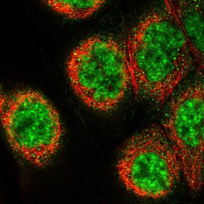 Immunocytochemistry/Immunofluorescence: LIN10 Antibody [NBP1-88454] - Staining of human cell line A-431 shows localization to nuclear speckles & cytosol.