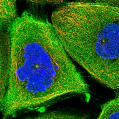 Immunocytochemistry/Immunofluorescence: TCHP Antibody [NBP1-89572] - Immunofluorescent staining of human cell line A-431 shows localization to plasma membrane, cytosol & centrosome.