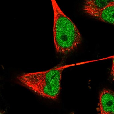 Immunocytochemistry/Immunofluorescence: RNASEH2B Antibody [NBP1-90865] - Immunofluorescent staining of human cell line U-251 MG shows localization to nucleoplasm.