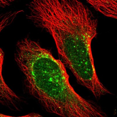 Immunocytochemistry/Immunofluorescence: RNF121 Antibody [NBP1-92339] - Immunofluorescent staining of human cell line U-2 OS shows localization to nucleus, the Golgi apparatus & vesicles.