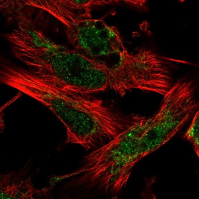 Immunocytochemistry/Immunofluorescence: CARKL Antibody [NBP1-91151] - Staining of human cell line U-251MG shows positivity in nucleus but not nucleoli and mitochondria.