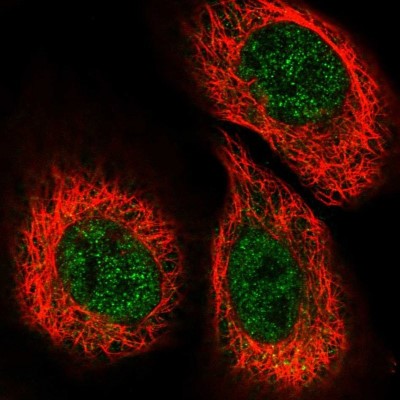 Immunocytochemistry/Immunofluorescence: FAM155A Antibody [NBP1-90982] - Staining of human cell line A-431 shows positivity in nucleus but not nucleoli.