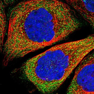 Immunocytochemistry/Immunofluorescence: SLC9B1 Antibody [NBP1-90664] - Staining of human cell line A-431 shows positivity in cytoplasm.