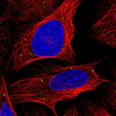 Immunocytochemistry/Immunofluorescence: ANKRD2 Antibody [NBP1-91669] - Immunofluorescent staining of human cell line U-2 OS shows localization to vesicles.