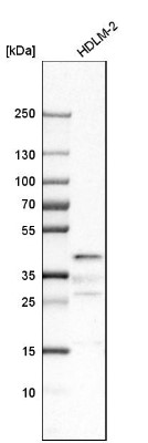 Western Blot: C19orf66 Antibody [NBP1-90417] - Analysis in human cell line HDLM-2.
