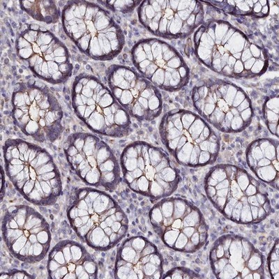 Immunohistochemistry-Paraffin: C4orf19 Antibody [NBP1-91734] - Staining of human rectum shows moderate membranous positivity in glandular cells.