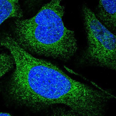 Immunocytochemistry/Immunofluorescence: UFL1 Antibody [NBP1-90691] - Staining of human cell line U-2 OS shows positivity in endoplasmic reticulum.