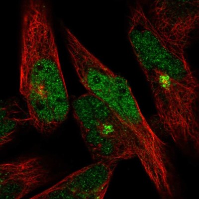 Immunocytochemistry/Immunofluorescence: RBM20 Antibody [NBP1-91002] - Immunofluorescent staining of human cell line RH-30 shows localization to nucleus & the Golgi apparatus.